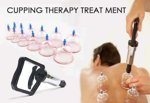 cupping therapy treatment handle and cups set